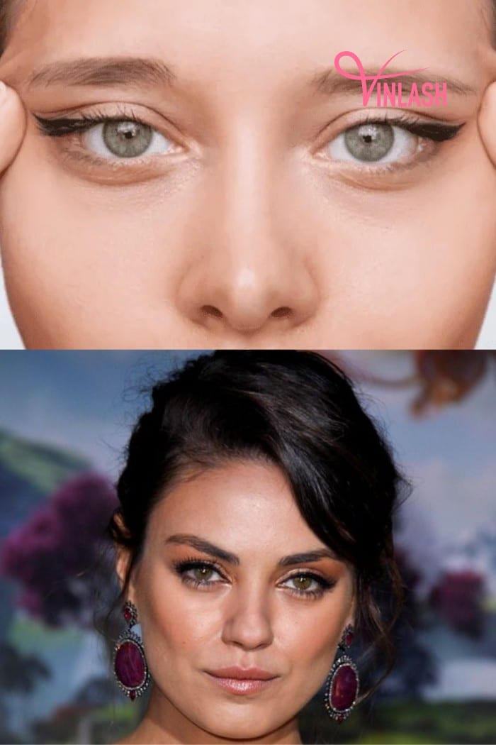 What Are The Characteristics Of Almond Eyes?