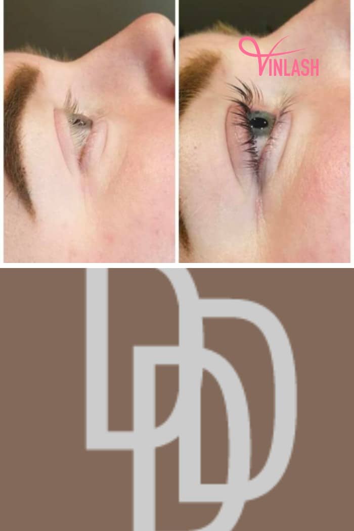 Distinction Beauty was established in 2008 by a group of dedicated Swedish professionals